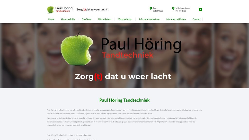 Portfolio E-Markers | Paul Höring Tandtechniek